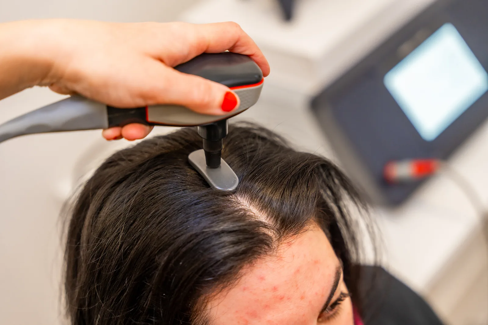 Haarwachstum-Pflege mit Spezialgerät im ADEVE Salon