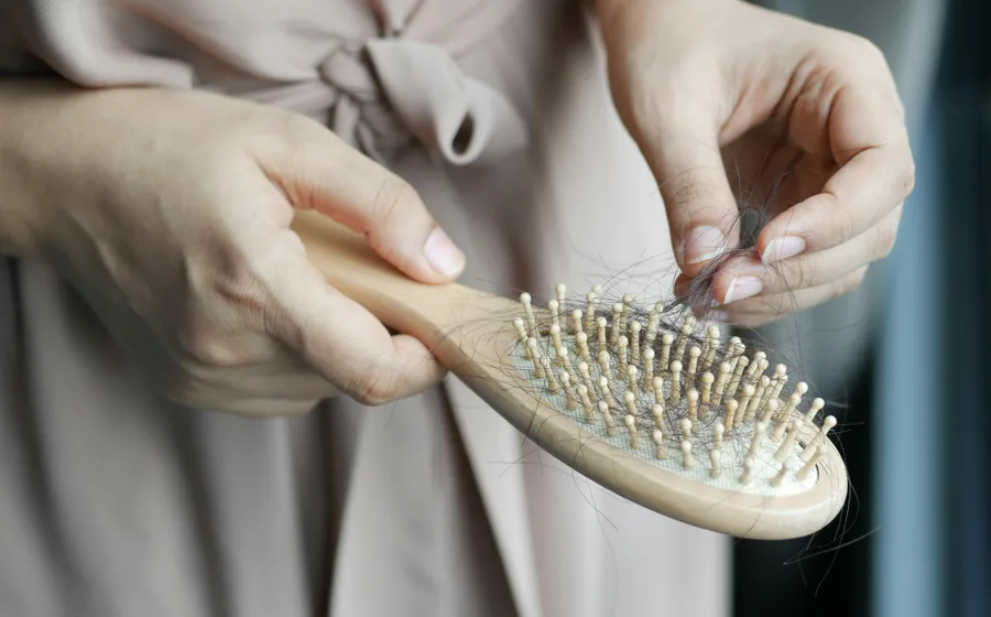 Haarausfall erkennen: Haare in der Bürste als Zeichen für Kopfhaut- und Haaranalyse bei ADEVE